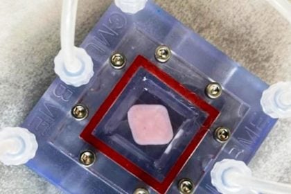 Πώς αλλάζει την Ιατρική η 3D βιοεκτύπωση