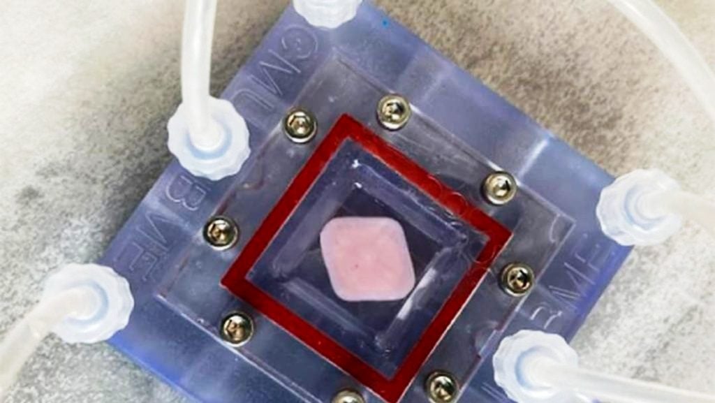 Πώς αλλάζει την Ιατρική η 3D βιοεκτύπωση