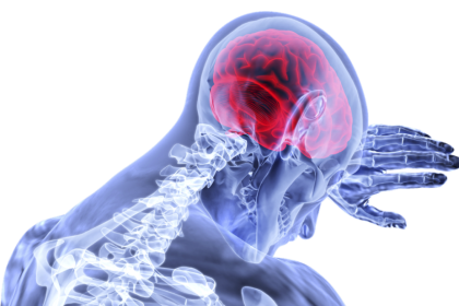 Η εμμηνόπαυση συνδέεται με αλλαγές στον εγκέφαλο που μοιάζουν με τη νόσο Αλτσχάιμερ