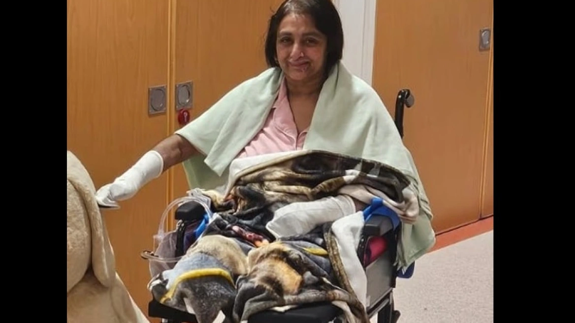 Γυναίκα έχασε όλα τα άκρα της από σηψαιμία από σκύλο που της έγλειψε μια πληγή