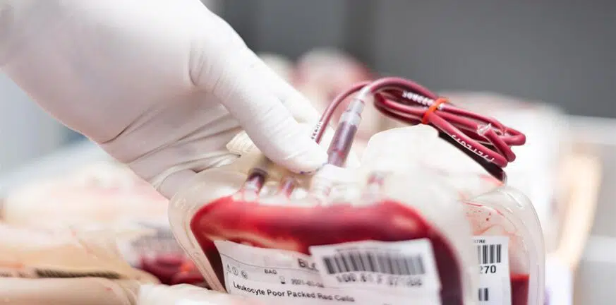 Έκκληση για αίμα από την Ελληνική Ομοσπονδία Θαλασσαιμίας - 55 ασθενείς σε καθεστώς αναβολής μεταγγίσεων στο Νοσοκομείο του Ρίου