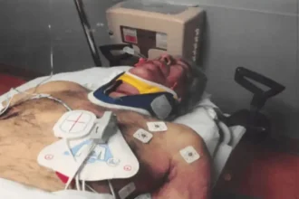 Θάνατος Επστάιν: Ιατροδικαστής αμφισβητεί την αυτοκτονία, μιλάει για «πιθανό στραγγαλισμό» και ζητά επανεξέταση