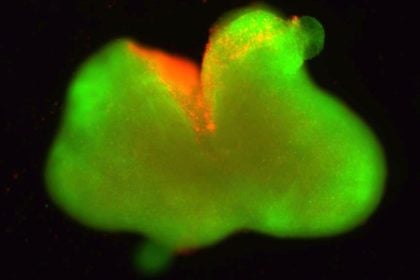 Ερευνητές ανέπτυξαν οργανοειδή νωτιαίου μυελού