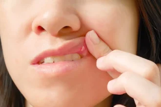 Τι σημαίνουν πραγματικά οι λευκές κηλίδες στο στόμα ή στα γεννητικά όργανα;